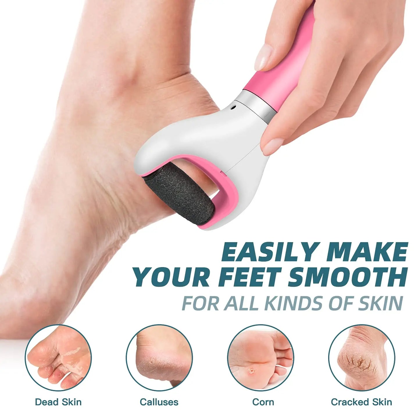 Foot Callus Remover – Remove Dead Skin Safely & Painlessly