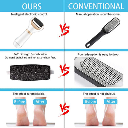 Foot Callus Remover – Remove Dead Skin Safely & Painlessly